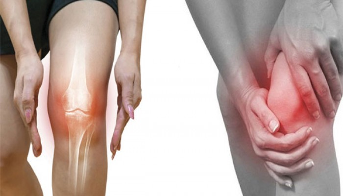 Glucosamine có tốt cho người bệnh xương khớp?