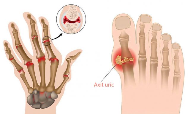 Gia công thực phẩm chức năng xương khớp đạt chuẩn GMP