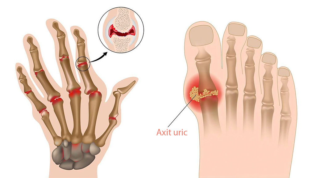 Gia công thực phẩm chức năng xương khớp đạt chuẩn GMP